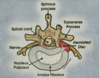 Chiropractor