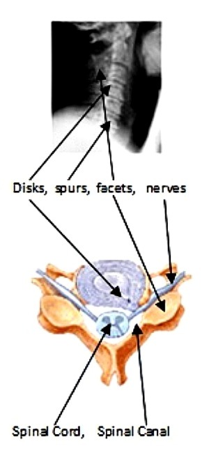 neck diagram 						
