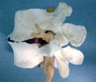 Pinched Nerve Image 3 Chiropractor